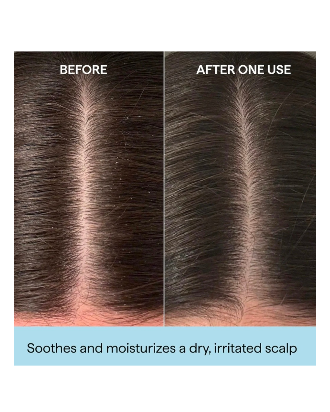 Briogeo Scalp Revival Rosemary Pre-Wash Oil 30ml